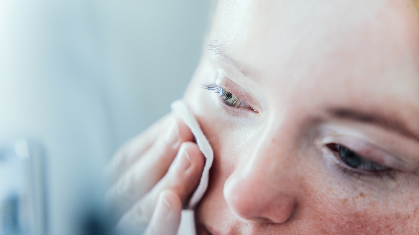 dry and sensitive skin